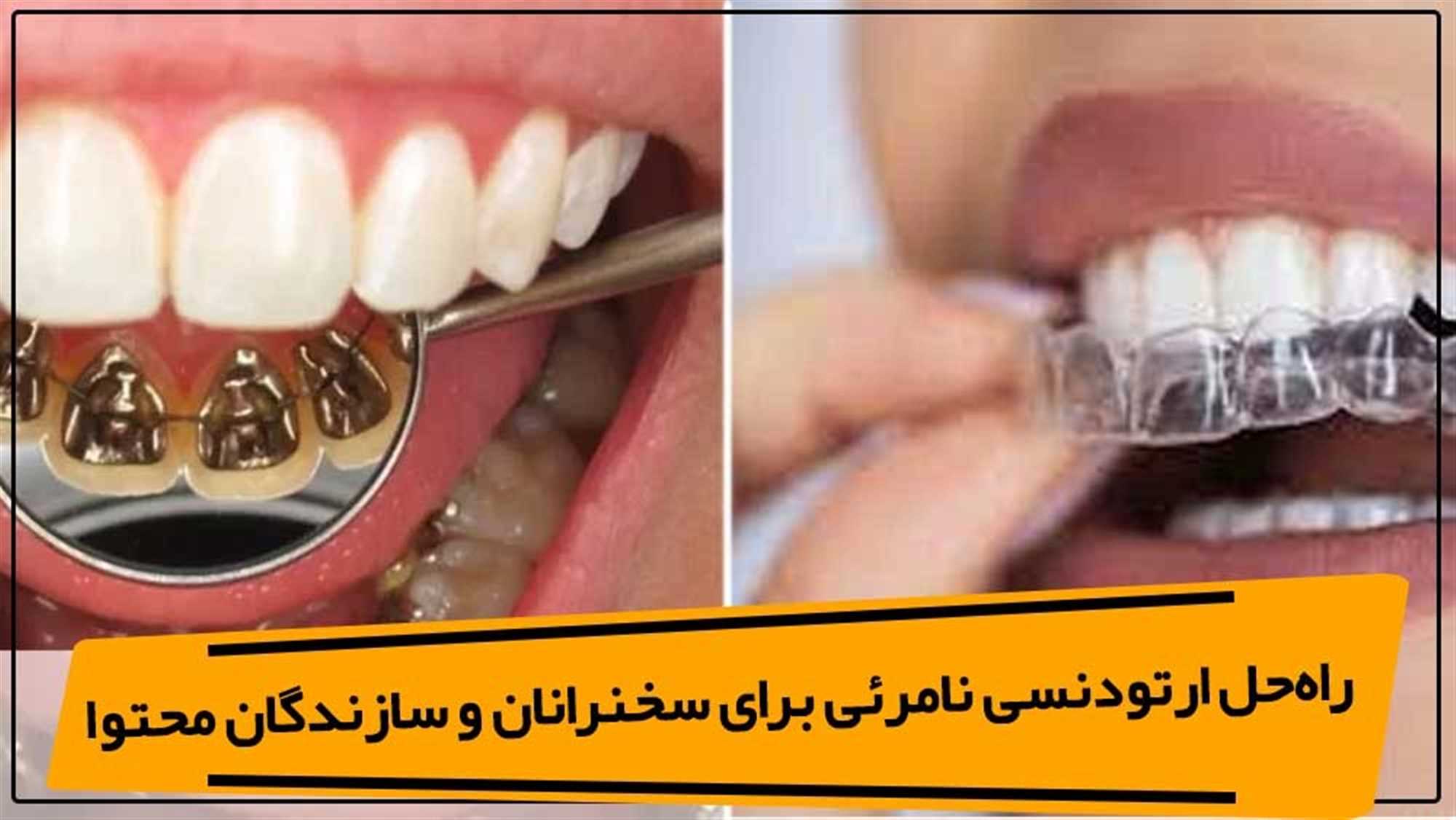 ارتودنسی نامرئی