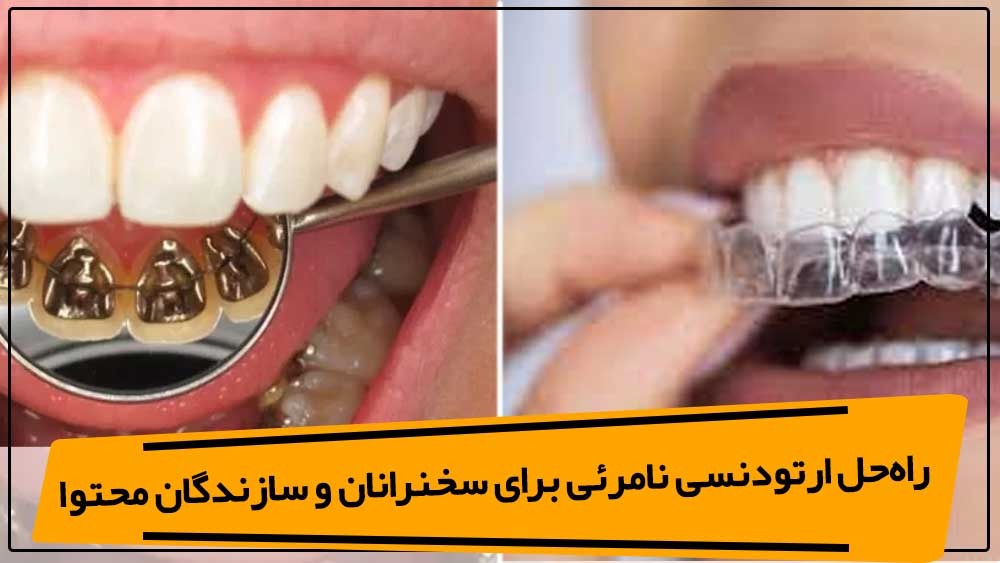 راه‌حل ارتودنسی نامرئی برای سخنرانان و سازندگان محتوا